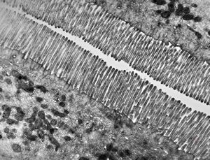 normal mucosa - jejunum - microvilli normal mucosa - jejunum - microvilli